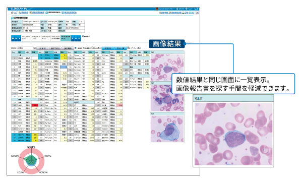 検査情報Web参照システム CLINILAN PV