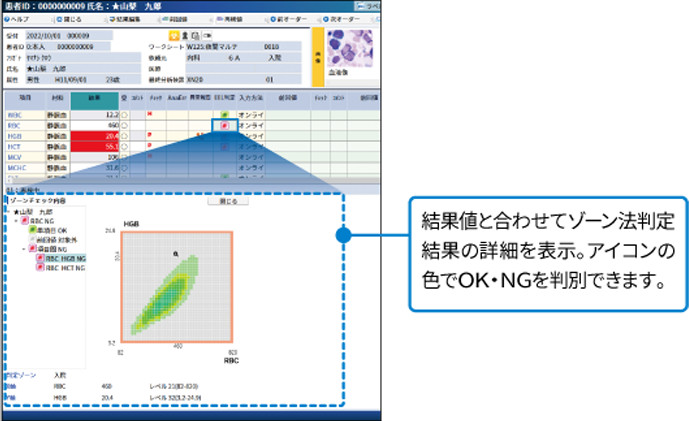 CLINILAN GL-3 Reとの連携