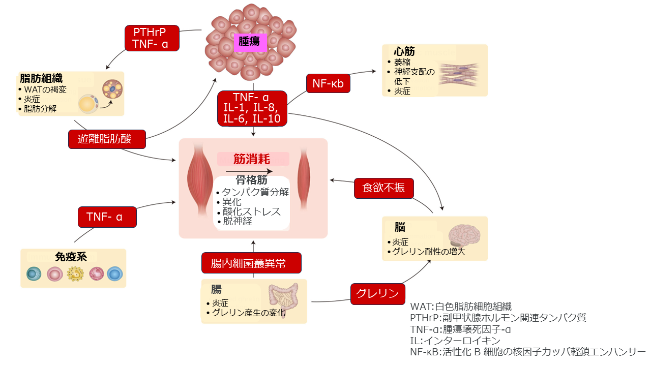 多臓器症候群としてのがん悪液質