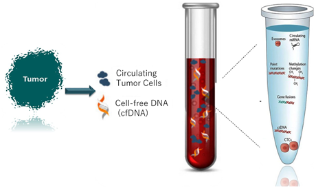 液体生検の概略図と、その遺伝子成分が血液中に現れる様子